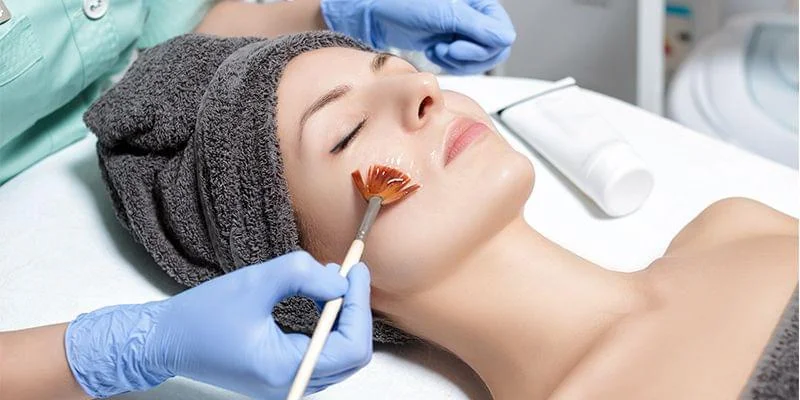 Chemical Peel Treatment in Wagholi Pune